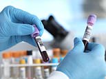 A blood test can predict dementia up to 15 years before symptoms strike: Experts say ‘breakthrough’ opens the door to a screening programme