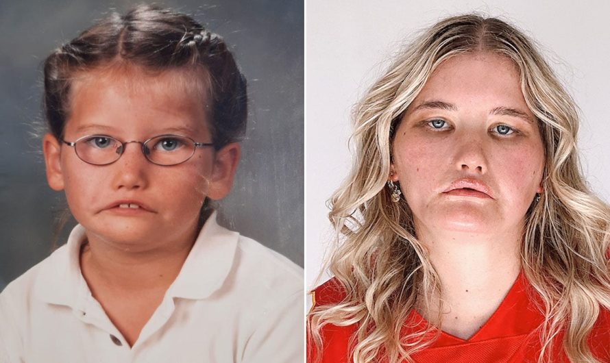 The girl who can’t smile: How a rare disorder became a young woman’s ‘greatest gift’