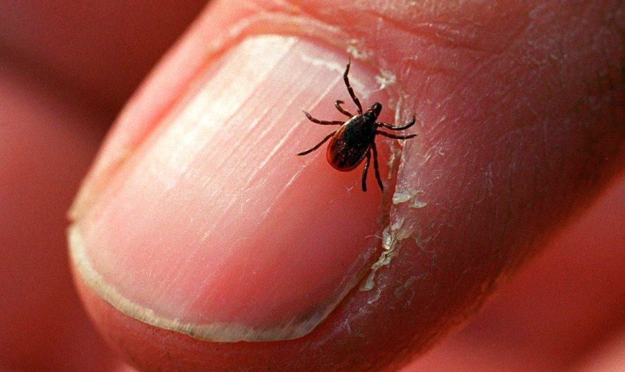 Summer is tick season, but these tips can help you avoid the bloodsucking bugs