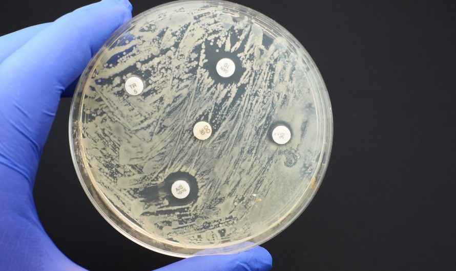 Canada introduces new guidelines to tackle antimicrobial resistance