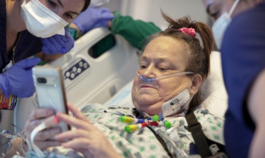 Woman who received experimental pig kidney transplant back on dialysis after new organ failed