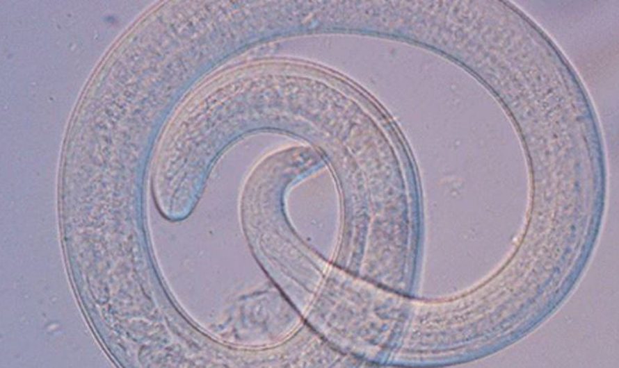 Undercooked bear meat to blame for infecting family with rare roundworm parasite: CDC