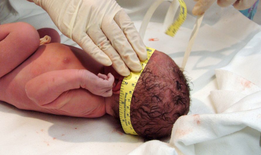 Medical Experts Alarmed by Out-of-Hospital Cesareans in Florida