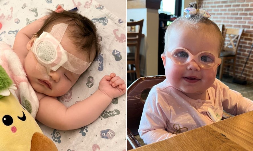 Nebraska baby born with cataracts has 3 eye surgeries to save her sight: ‘I just kept praying’